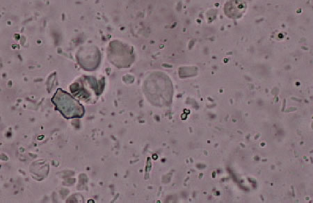 ジアルジア（Giardia duodenalis）のトロフォゾイト
