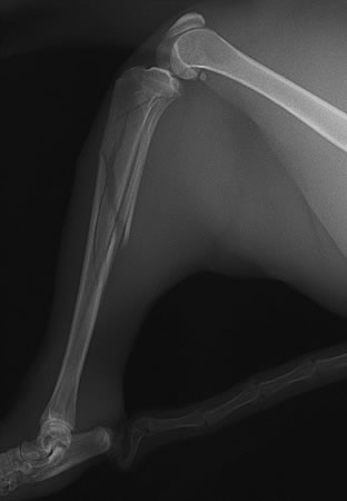 脛骨・腓骨骨折が認められたX線側面像