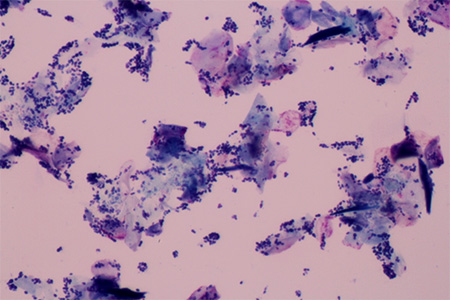 マラセチア性外耳炎の犬の耳垢塗抹染色顕微鏡像