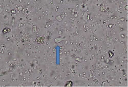糞便中のトリコモナス