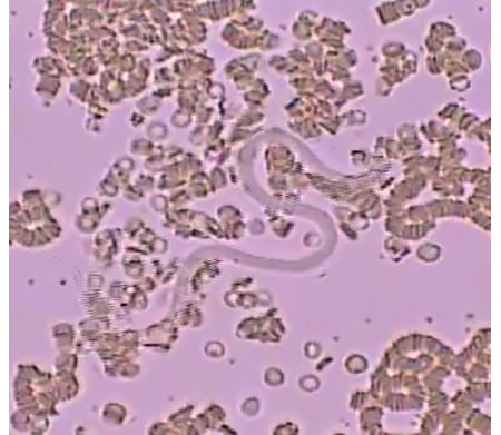 犬糸状虫感染犬の血液中に見られたミクロフィラリア